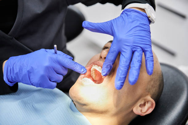 Best Emergency Denture Repair in Randallstown, MD