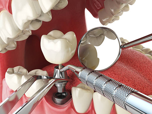 Best Emergency Gum Treatment in Randallstown, MD